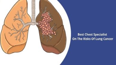 Best Chest Specialist On The Risks Of Lung Cancer