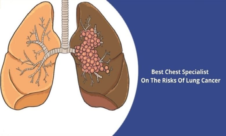 Best Chest Specialist On The Risks Of Lung Cancer
