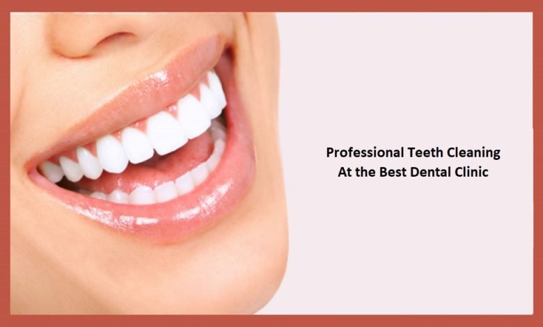 Professional Teeth Cleaning At the Best Dental Clinic